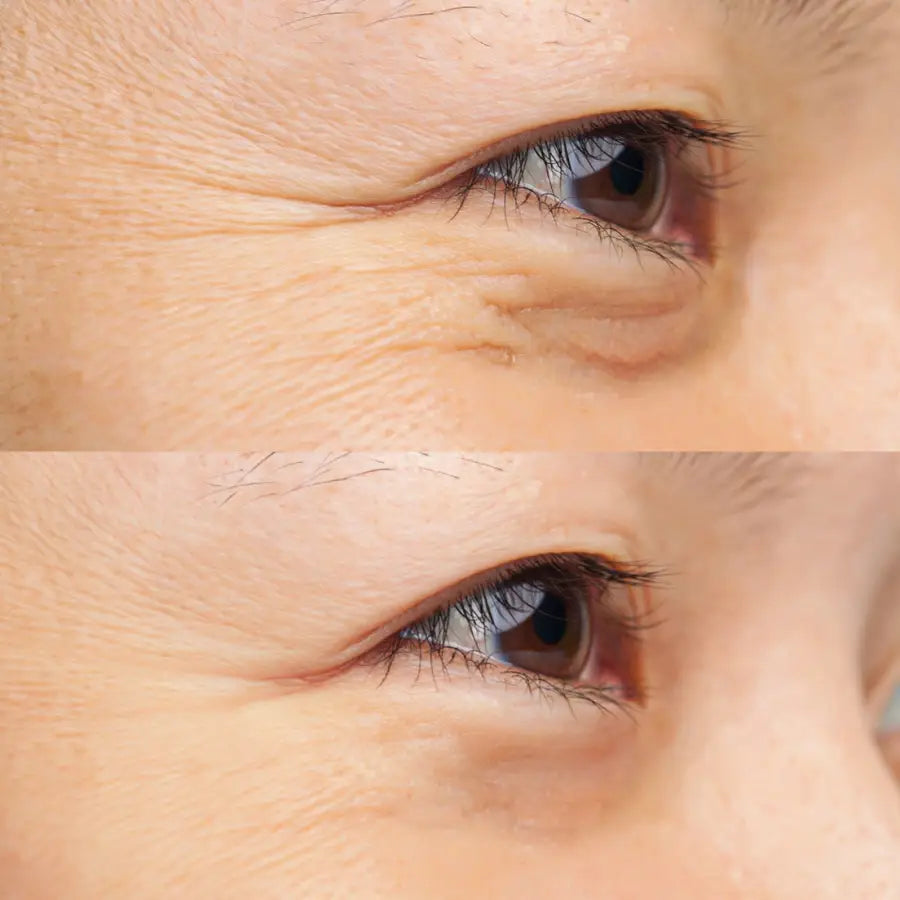 IREN Shizen Forever Young Serum 20ml – Ser facial anti-îmbătrânire cu peptide goji și apă termală BIYUSEN™