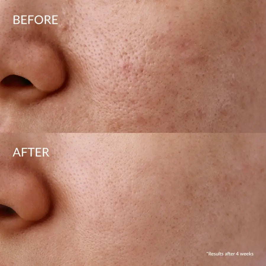 IREN Shizen Glow-Getter Renewal Serum 20ml – Ser facial exfoliant pentru pori dilatați puncte negre și piele ternă