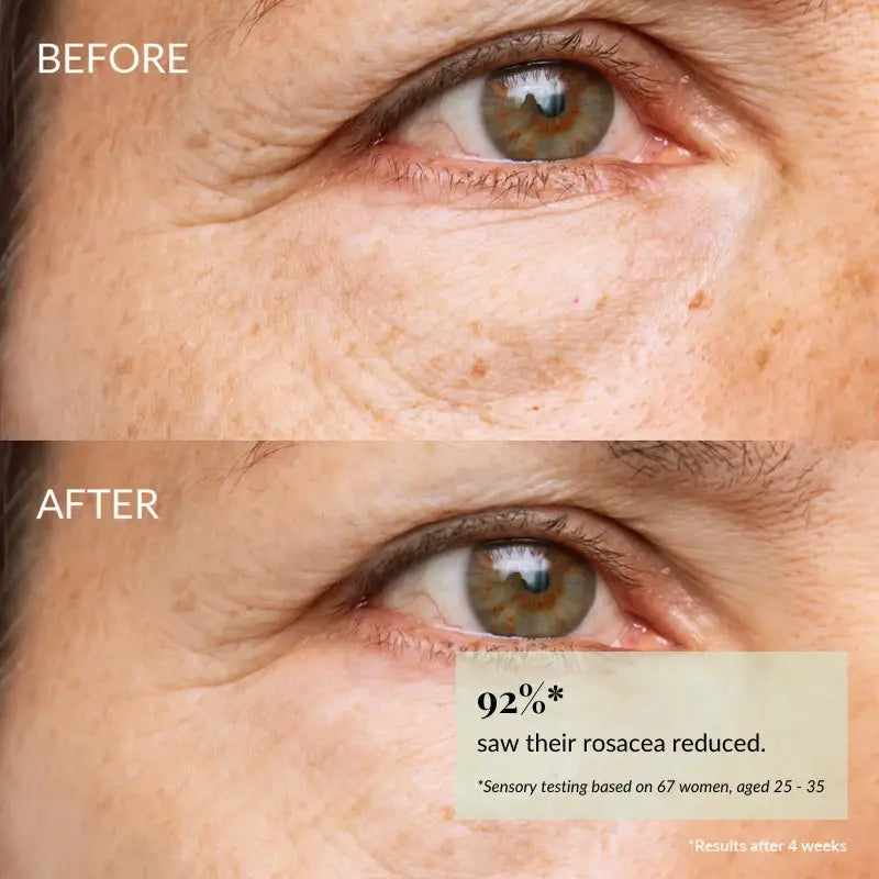 IREN Shizen Skin Reboot 20ml – Ser antioxidant cu rodie cofeină și alge roșii pentru un ten revitalizat luminos și