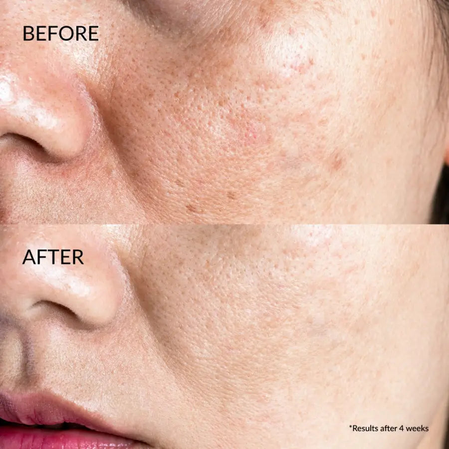 IREN Shizen Star Light – Ser iluminator pentru față cu Yuzu Alpha Arbutin și Niacinamide 20ml | Reduce petele