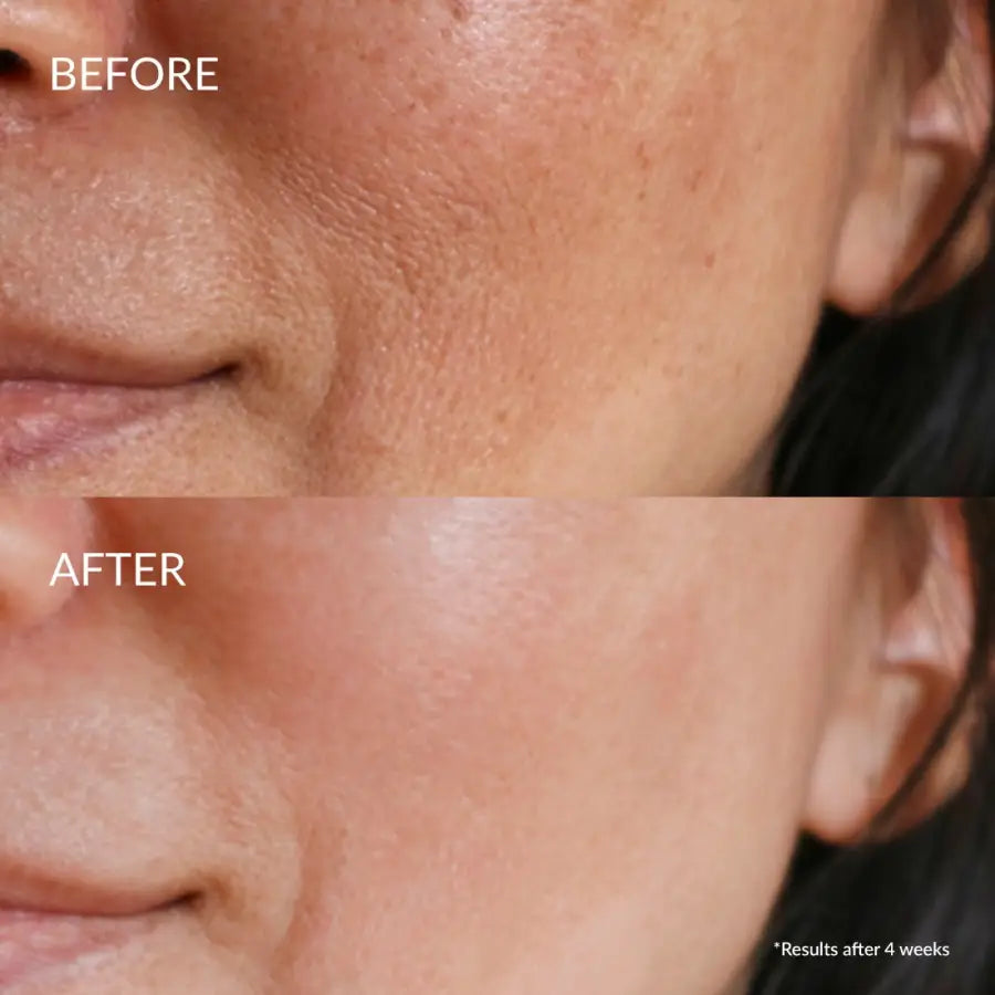 IREN Shizen Star Light – Ser iluminator pentru față cu Yuzu Alpha Arbutin și Niacinamide 20ml | Reduce petele