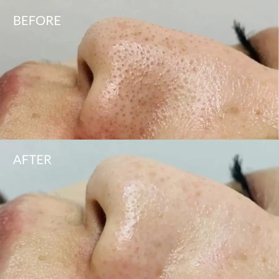 IREN Shizen Star Light – Ser iluminator pentru față cu Yuzu Alpha Arbutin și Niacinamide 20ml | Reduce petele