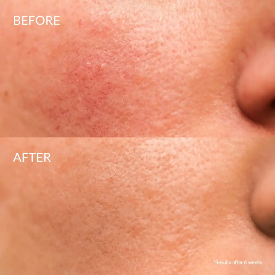 IREN Shizen Star Light – Ser iluminator pentru față cu Yuzu Alpha Arbutin și Niacinamide 20ml | Reduce petele