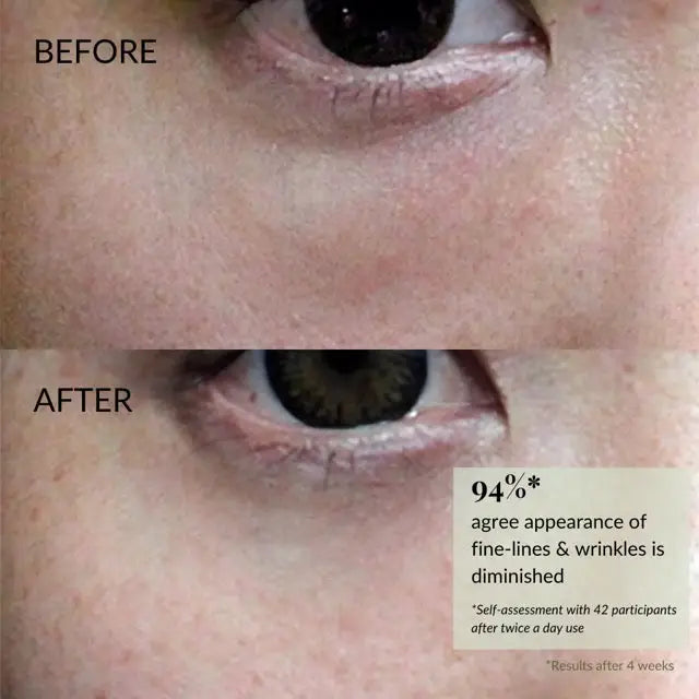 IREN Shizen TIMELESS ELIXIR 15ml – Cremă anti-îmbătrânire pentru conturul ochilor și buzelor cu Bakuchiol și roller