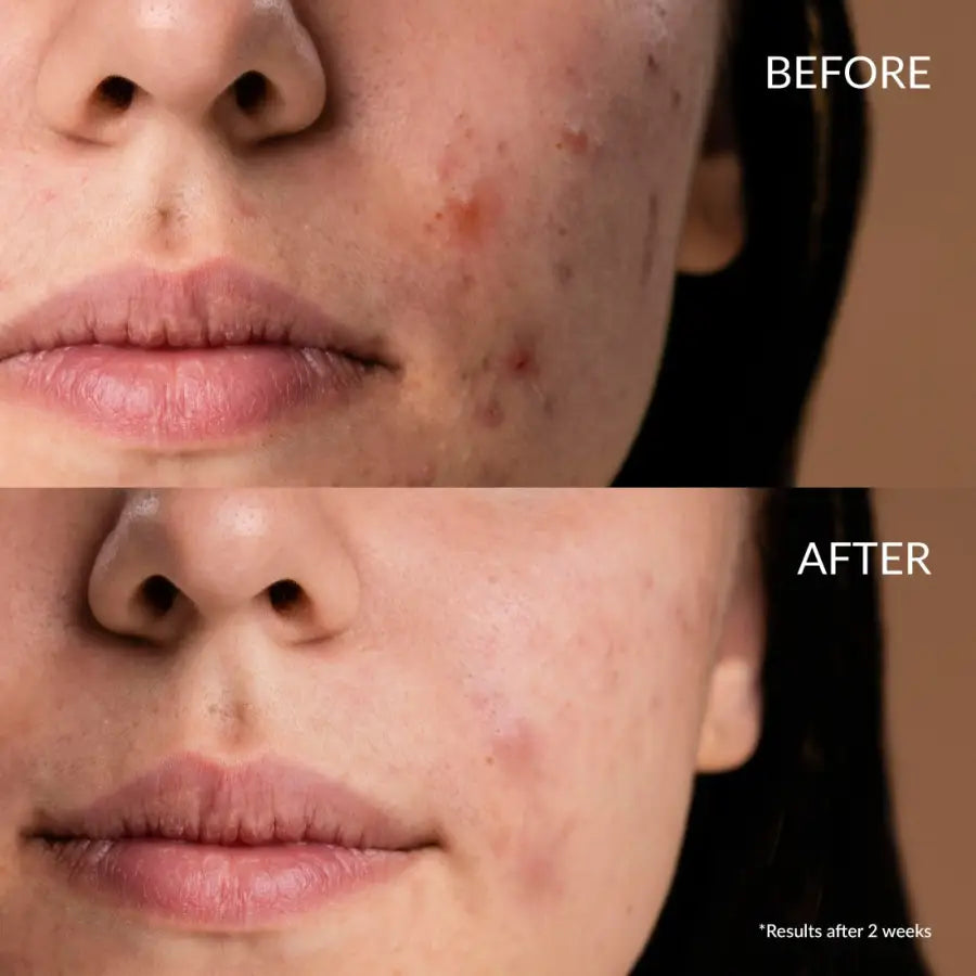 IREN Shizen Star Light – Ser iluminator pentru față cu Yuzu, Alpha Arbutin și Niacinamide 20ml | Reduce petele pigmentare și uniformizează tenul