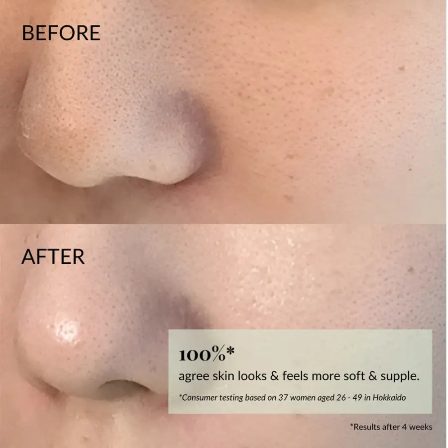 IREN Shizen FLOWERS IN BLOOM – Japanese Face Cream with Antioxidants and BIYUSEN™ Thermal Water - Explosive Hydration, Natural Radiance, and Advanced Urban Protection