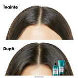 Set L’Oreal Professionnel Serie Expert Scalp Advanced Șampon Dermo-Regulator 300ml + Tratament Calmant pentru Scalp